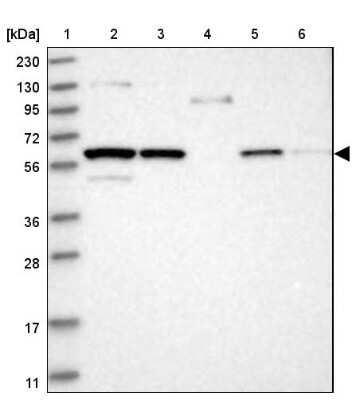 Western Blot: RUBCNL Antibody [NBP1-82141]