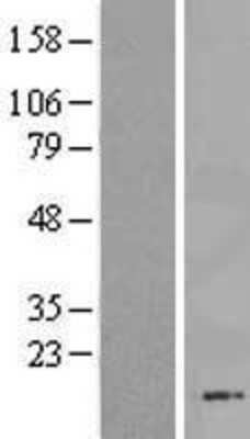 Western Blot: FAM216B Overexpression Lysate [NBL1-08162]