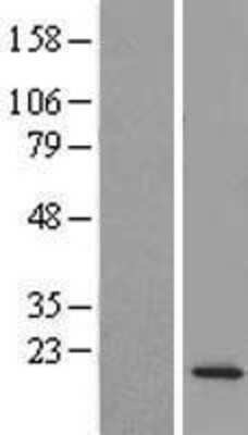 Western Blot: DTD2 Overexpression Lysate [NBL1-08172]