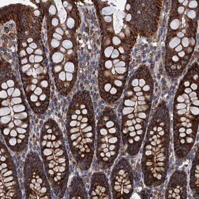 Immunohistochemistry-Paraffin: DGLUCY Antibody [NBP1-81920]