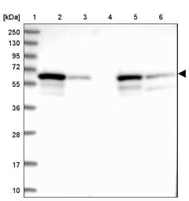 Western Blot: DGLUCY Antibody [NBP1-81920]