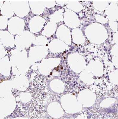 Immunohistochemistry: Ring Finger Protein 212B Antibody [NBP2-31000]