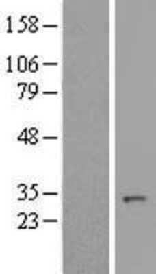 Western Blot: CLE7 homolog Overexpression Lysate [NBL1-08183]