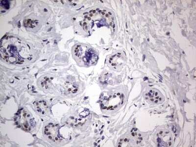 Immunohistochemistry: CLE7 homolog Antibody (OTI2A4) [NBP2-46591]