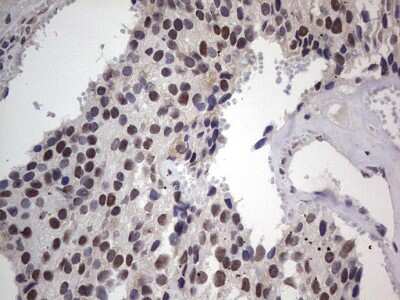 Immunohistochemistry: CLE7 homolog Antibody (OTI2A4) [NBP2-46591]
