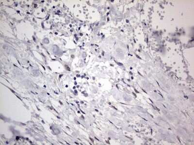 Immunohistochemistry: CLE7 homolog Antibody (OTI2A4) [NBP2-46591]