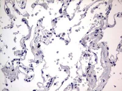 Immunohistochemistry: CLE7 homolog Antibody (OTI2A4) [NBP2-46591]