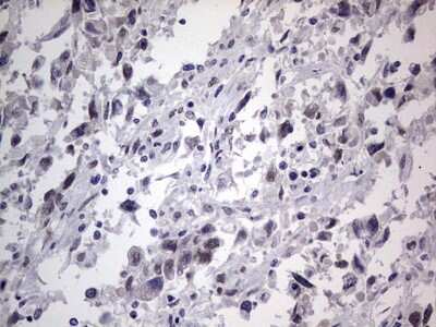 Immunohistochemistry: CLE7 homolog Antibody (OTI2A4) [NBP2-46591]
