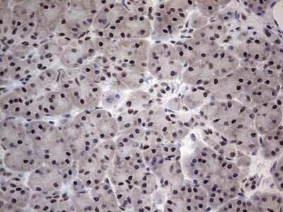 Immunohistochemistry: CLE7 homolog Antibody (OTI2A4) [NBP2-46591]