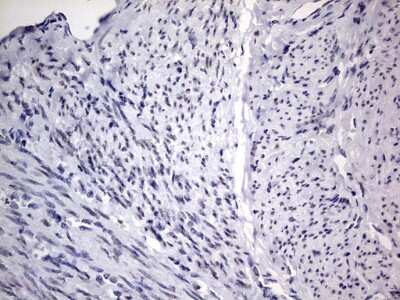 Immunohistochemistry: CLE7 homolog Antibody (OTI2A4) [NBP2-46591]