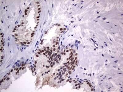 Immunohistochemistry: CLE7 homolog Antibody (OTI2A4) [NBP2-46591]