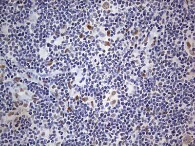 Immunohistochemistry: CLE7 homolog Antibody (OTI2A4) [NBP2-46591]