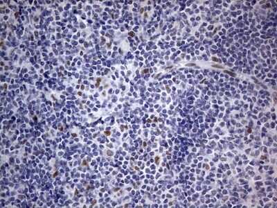 Immunohistochemistry: CLE7 homolog Antibody (OTI2A4) [NBP2-46591]