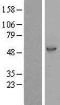 Western Blot: LRRC74A Overexpression Lysate [NBP2-08416]