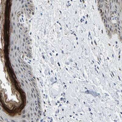 Immunohistochemistry-Paraffin: C14orf177 Antibody [NBP1-82049]
