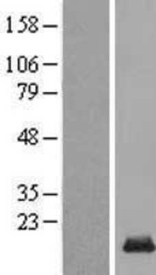 Western Blot: C14orf177 Overexpression Lysate [NBL1-08185]