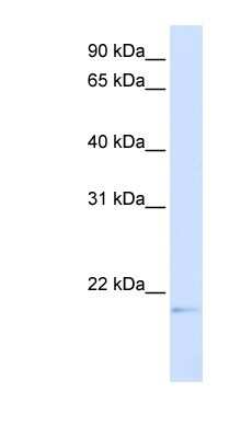 Western Blot: C14orf180 Antibody [NBP1-59522]