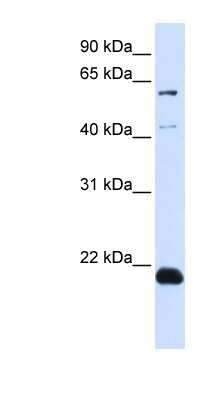 Western Blot: C14orf180 Antibody [NBP1-59680]