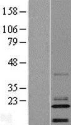 Western Blot: C14orf180 Overexpression Lysate [NBL1-08187]