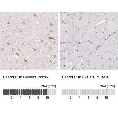 Immunohistochemistry-Paraffin: ARMH4 Antibody [NBP1-86526]