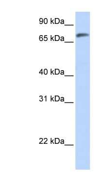 Western Blot: ARMH4 Antibody [NBP1-70435]