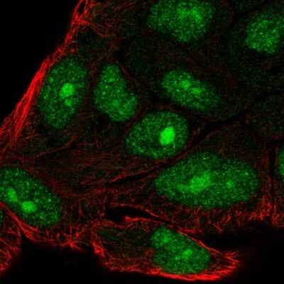 Immunocytochemistry/ Immunofluorescence: C14orf39 Antibody [NBP2-32473]