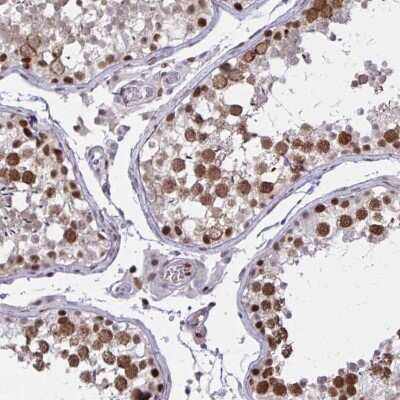 Immunohistochemistry-Paraffin: C14orf39 Antibody [NBP2-32473]
