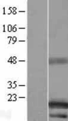 Western Blot: LINC00521 Overexpression Lysate [NBL1-08192]