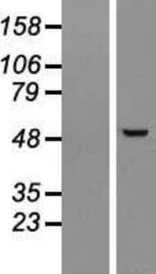 Western Blot: PPP1R36 Overexpression Lysate [NBL1-08193]