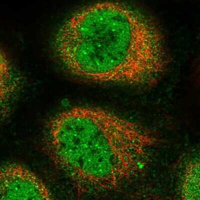 Immunocytochemistry/ Immunofluorescence: CLBA1 Antibody [NBP2-14516]