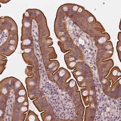 Immunohistochemistry: CLBA1 Antibody [NBP2-49324]