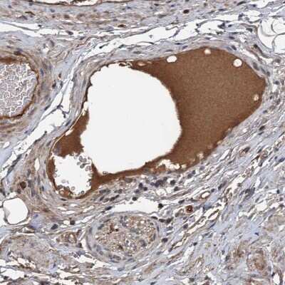 Immunohistochemistry-Paraffin: TEDC1 Antibody [NBP2-38439]