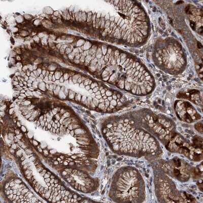 Immunohistochemistry-Paraffin: TEDC1 Antibody [NBP1-85864]