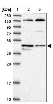 Western Blot: TEDC1 Antibody [NBP1-85864]