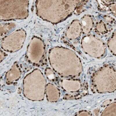 Immunohistochemistry-Paraffin: C14orf93 Antibody [NBP1-82308]