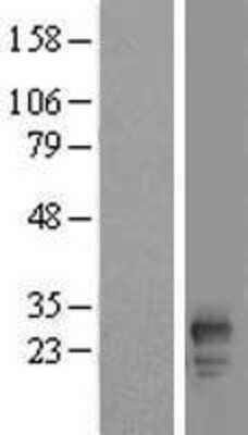 Western Blot: FAM219B Overexpression Lysate [NBL1-08199]