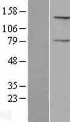 Western Blot: NPAP1 Overexpression Lysate [NBL1-08200]