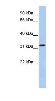 Western Blot: CFAP161 Antibody [NBP1-70437]