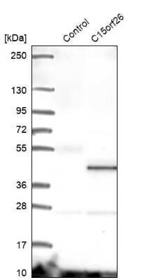 Western Blot: CFAP161 Antibody [NBP2-14378]