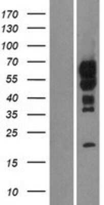 Western Blot: TMEM266 Overexpression Lysate [NBP2-05386]