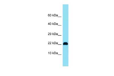 Western Blot: C15orf32 Antibody [NBP3-10740]