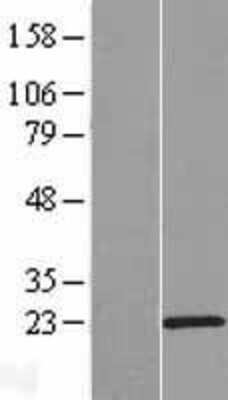 Western Blot: C15orf32 Overexpression Lysate [NBP2-05282]