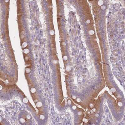 Immunohistochemistry-Paraffin: Arpin Antibody [NBP2-46664]