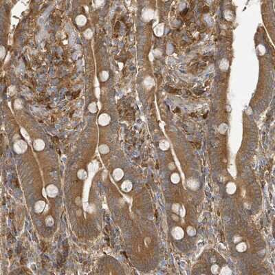 Immunohistochemistry-Paraffin: Arpin Antibody [NBP2-46747]