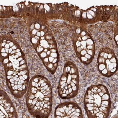 Immunohistochemistry-Paraffin: Arpin Antibody [NBP2-46801]