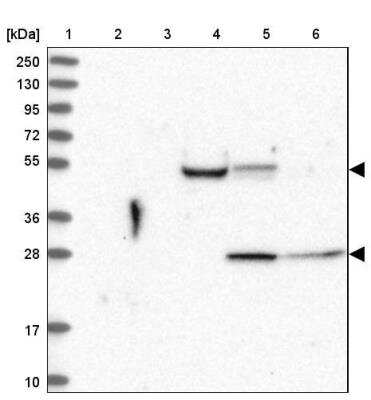 Western Blot: Arpin Antibody [NBP2-46664]