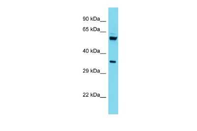 Western Blot: C15orf41 Antibody [NBP2-82842]