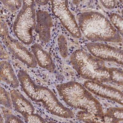 Immunohistochemistry-Paraffin: CCDC9B Antibody [NBP1-93763]