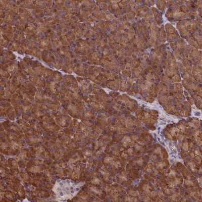 Immunohistochemistry-Paraffin: CCDC9B Antibody [NBP1-93764]