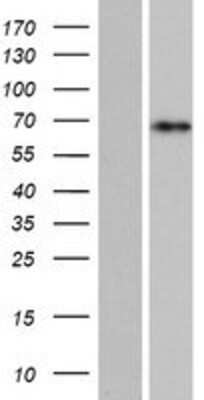 Western Blot: CCDC9B Overexpression Lysate [NBP2-04496]